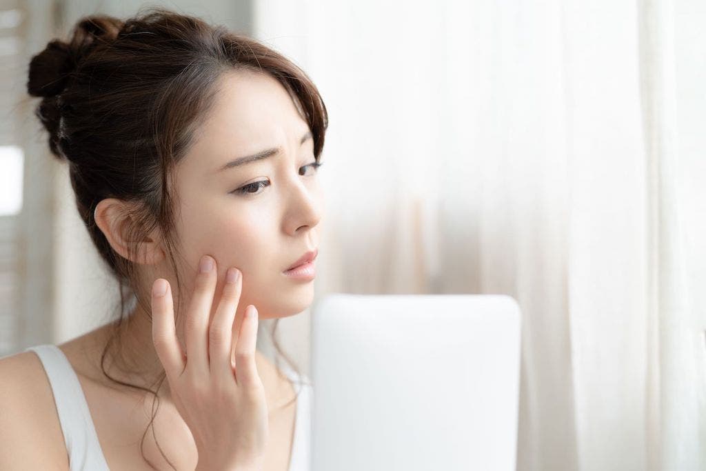 Cách chọn kem chống nắng dành cho da dầu mụn hiệu quả